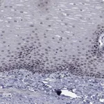 Atlas Antibodies Anti-NVL Antibody