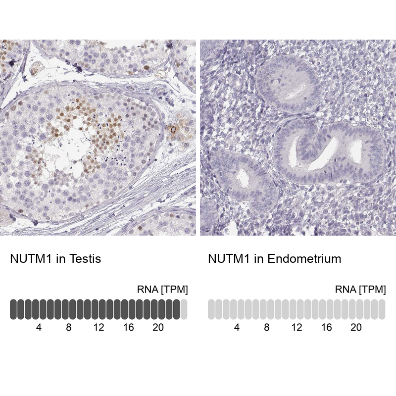 Atlas Antibodies Anti-NUTM1 Antibody