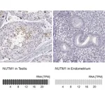 Atlas Antibodies Anti-NUTM1 Antibody