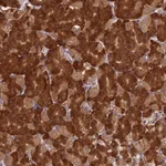 Atlas Antibodies Anti-NXNL2 Antibody