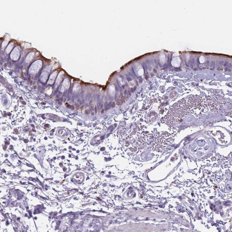 Atlas Antibodies Anti-NWD2 Antibody