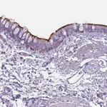 Atlas Antibodies Anti-NWD2 Antibody