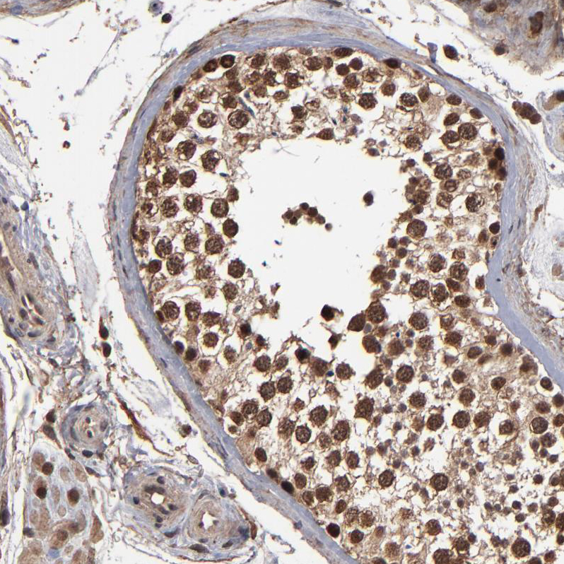 Atlas Antibodies Anti-NXF2B Antibody