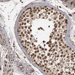 Atlas Antibodies Anti-NXF2B Antibody