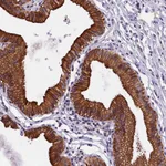 Atlas Antibodies Anti-NXNL1 Antibody