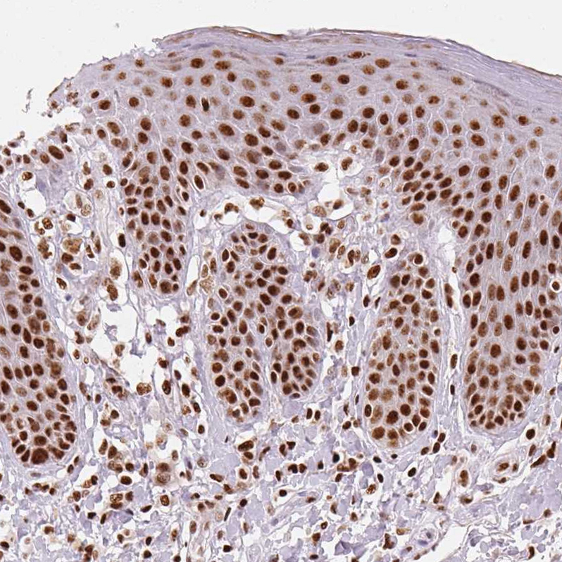 Atlas Antibodies Anti-NXF1 Antibody