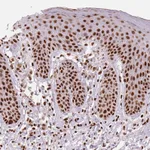 Atlas Antibodies Anti-NXF1 Antibody