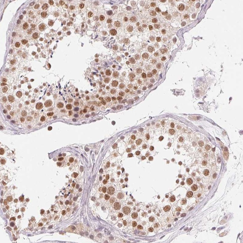 Atlas Antibodies Anti-NXF3 Antibody
