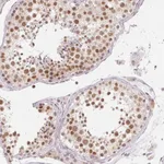 Atlas Antibodies Anti-NXF3 Antibody