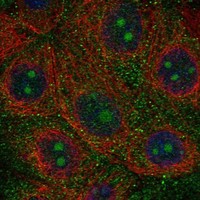 Atlas Antibodies Anti-NWD1 Antibody
