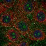 Atlas Antibodies Anti-NWD1 Antibody