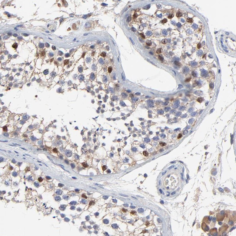 Atlas Antibodies Anti-NXF3 Antibody
