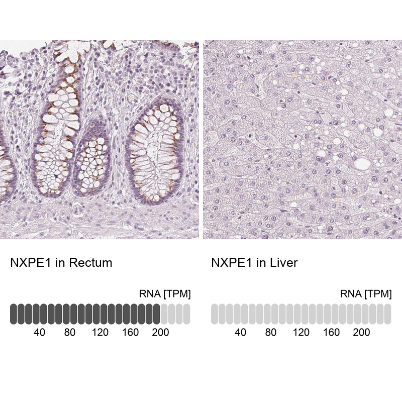 Atlas Antibodies Anti-NXPE1 Antibody