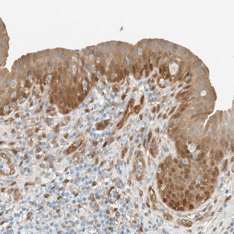 Atlas Antibodies Anti-NXN Antibody