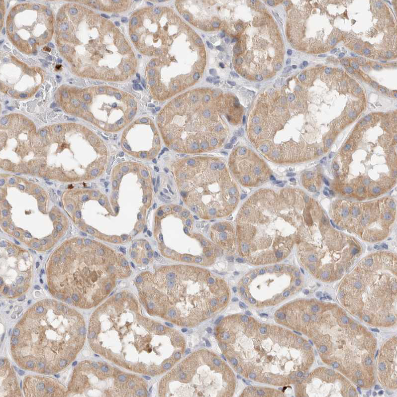 Atlas Antibodies Anti-NXT2 Antibody