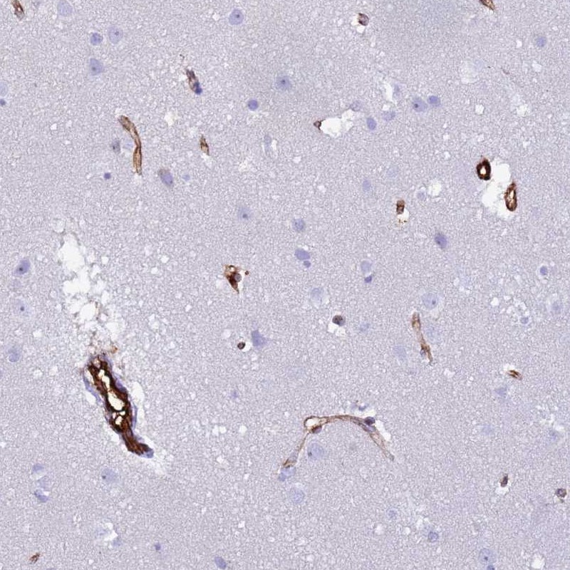 Atlas Antibodies Anti-NXPH1 Antibody