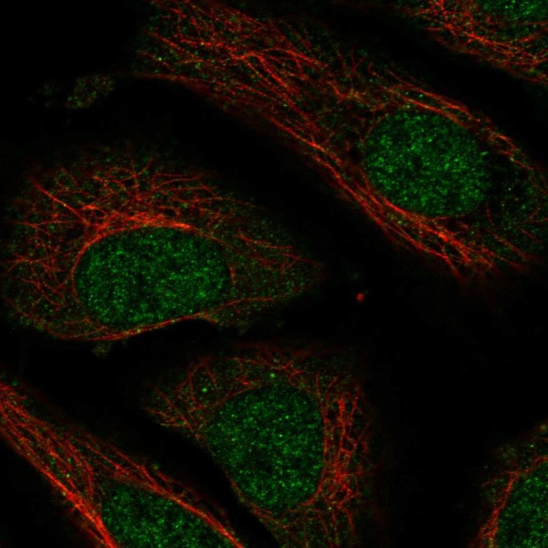 Atlas Antibodies Anti-NXT2 Antibody