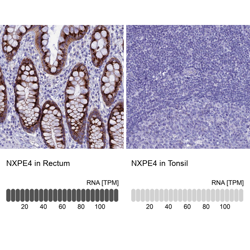 Atlas Antibodies Anti-NXPE4 Antibody