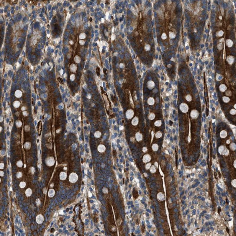 Atlas Antibodies Anti-NYNRIN Antibody