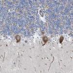Atlas Antibodies Anti-NYAP1 Antibody