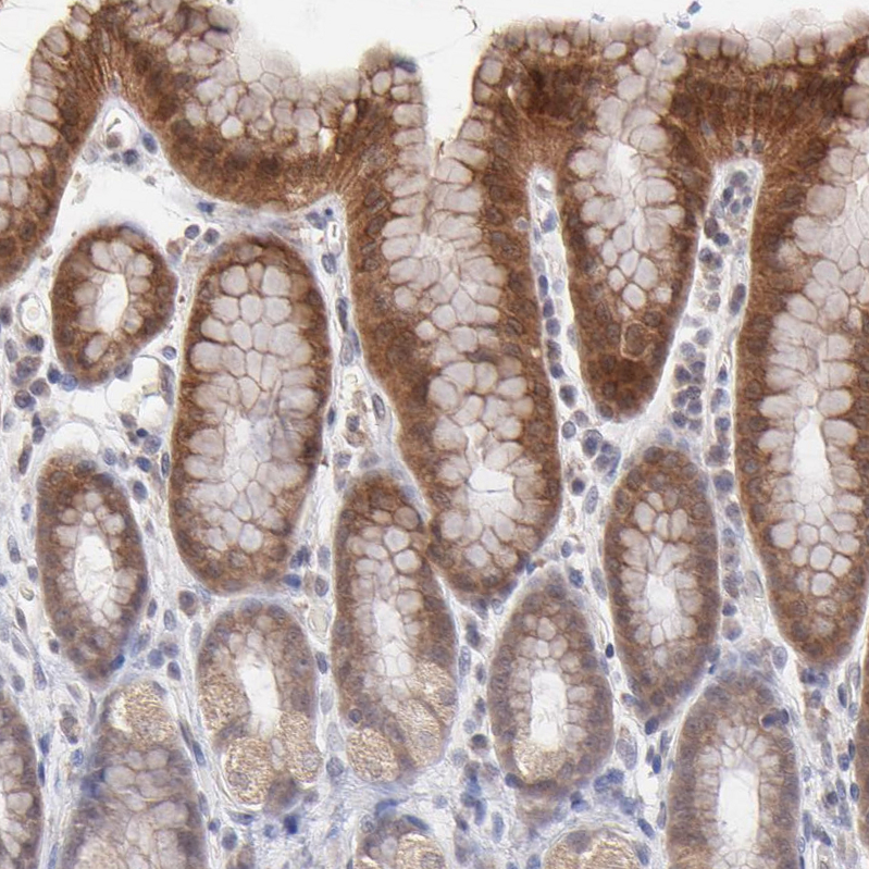 Atlas Antibodies Anti-OAS1 Antibody