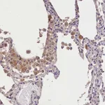 Atlas Antibodies Anti-OAS3 Antibody