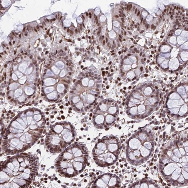 Atlas Antibodies Anti-NYAP2 Antibody