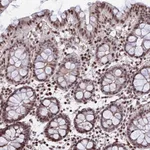 Atlas Antibodies Anti-NYAP2 Antibody
