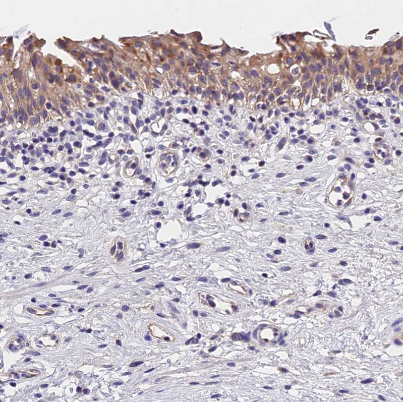 Atlas Antibodies Anti-OAS3 Antibody