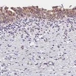 Atlas Antibodies Anti-OAS3 Antibody