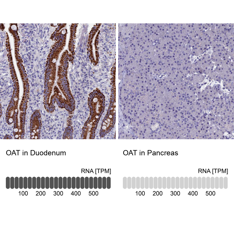 Atlas Antibodies Anti-OAT Antibody