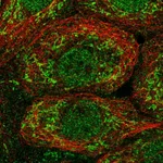 Atlas Antibodies Anti-OAT Antibody