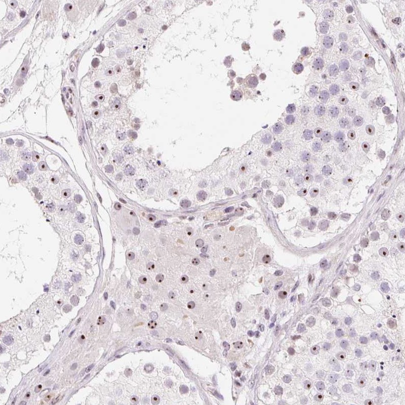 Atlas Antibodies Anti-OBP2A Antibody