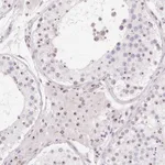 Atlas Antibodies Anti-OBP2A Antibody