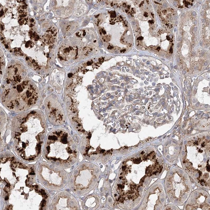 Atlas Antibodies Anti-OBSL1 Antibody