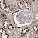 Atlas Antibodies Anti-OBSL1 Antibody