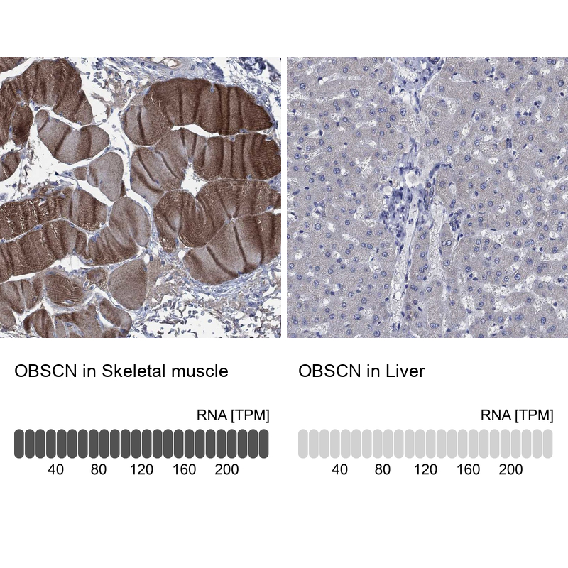 Atlas Antibodies Anti-OBSCN Antibody