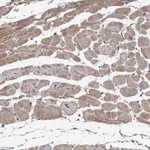 Atlas Antibodies Anti-OBSL1 Antibody