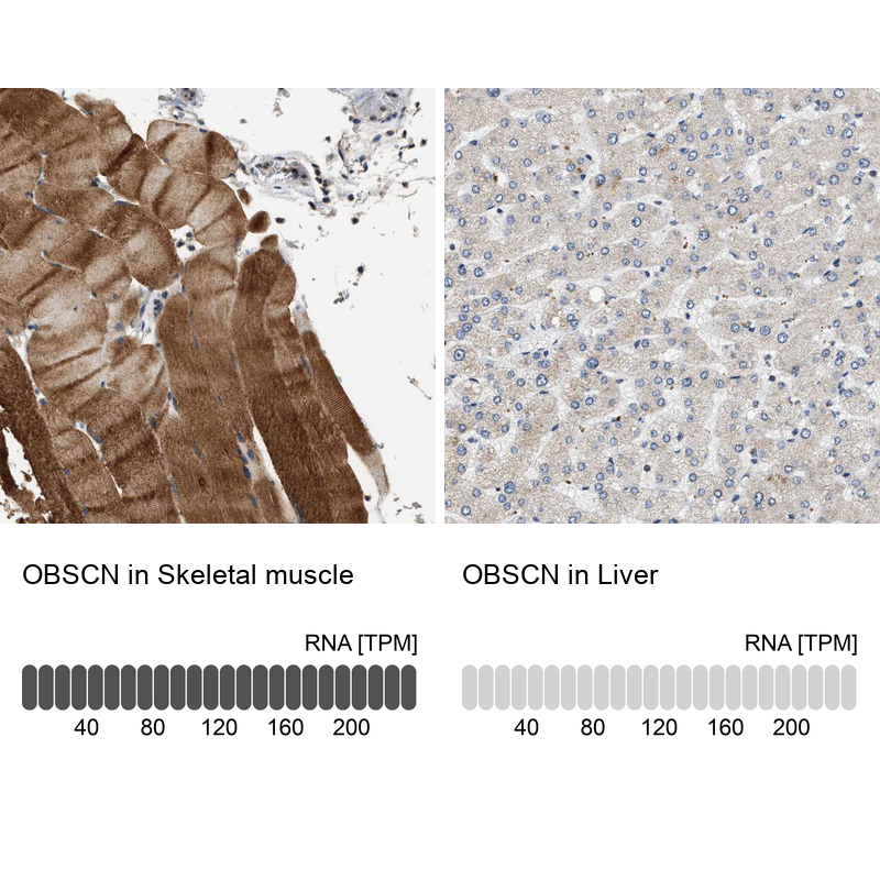 Atlas Antibodies Anti-OBSCN Antibody