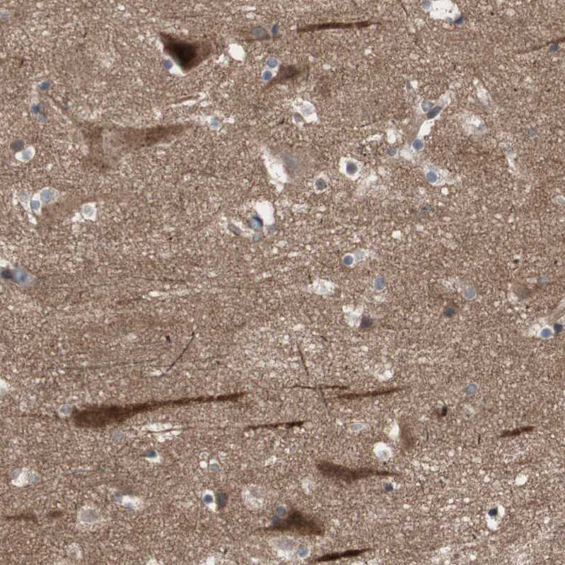 Atlas Antibodies Anti-OAZ1 Antibody