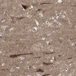 Atlas Antibodies Anti-OAZ1 Antibody