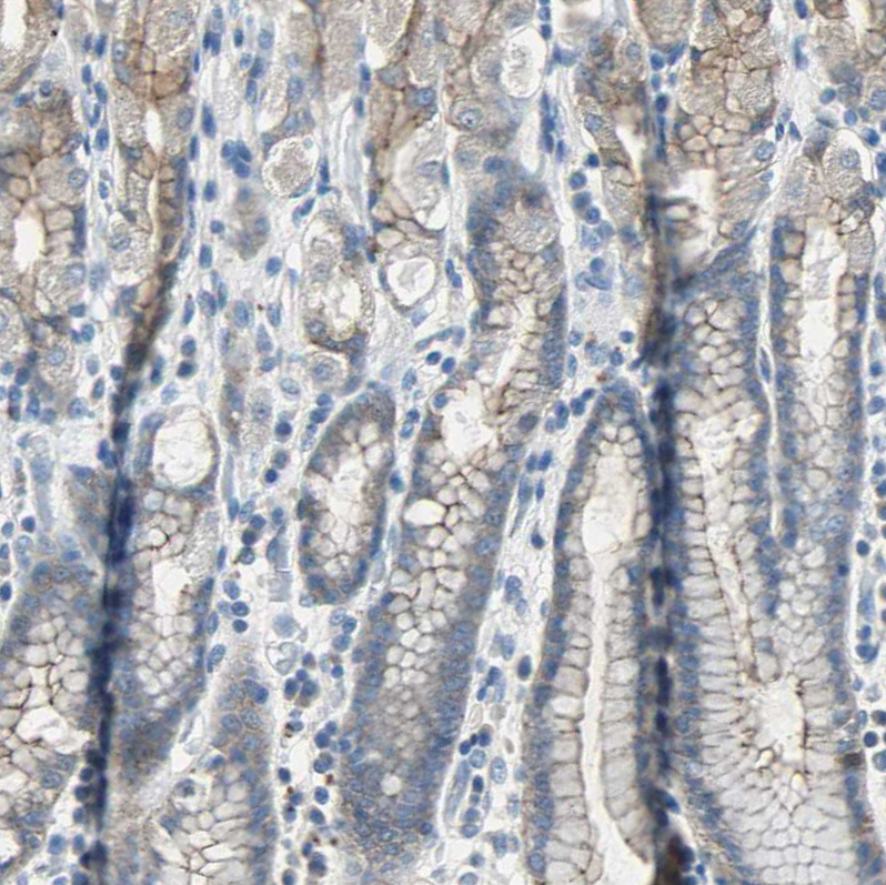Atlas Antibodies Anti-OCLN Antibody
