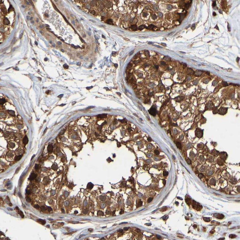 Atlas Antibodies Anti-OCRL Antibody