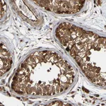 Atlas Antibodies Anti-OCRL Antibody