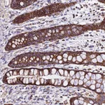 Atlas Antibodies Anti-OCIAD1 Antibody