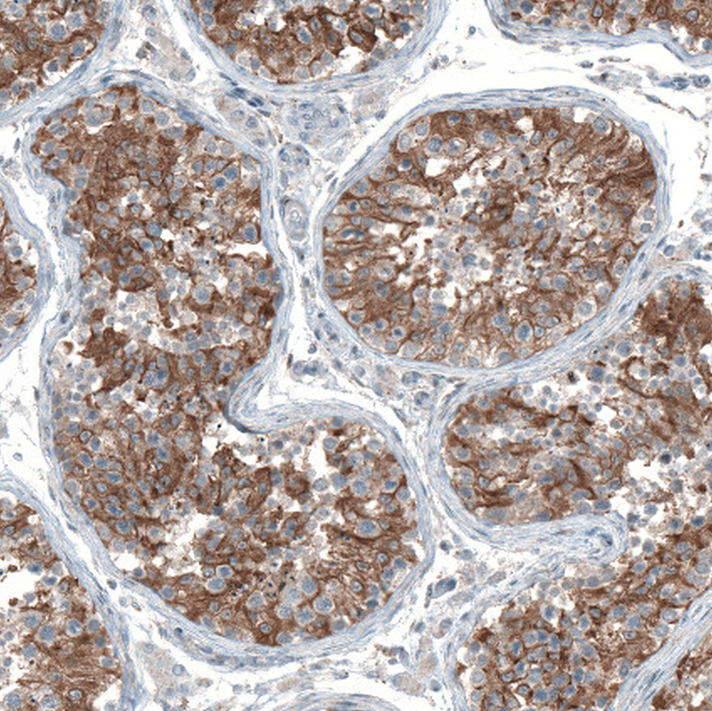 Atlas Antibodies Anti-OCM Antibody