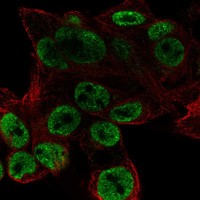 Atlas Antibodies Anti-ODAM Antibody
