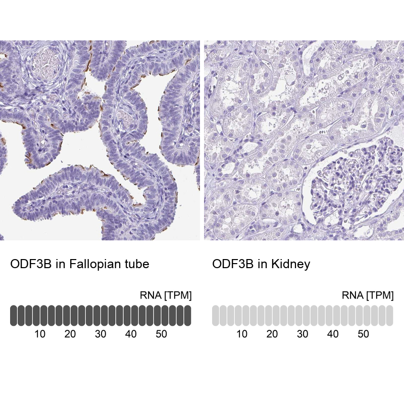 Atlas Antibodies Anti-ODF3B Antibody