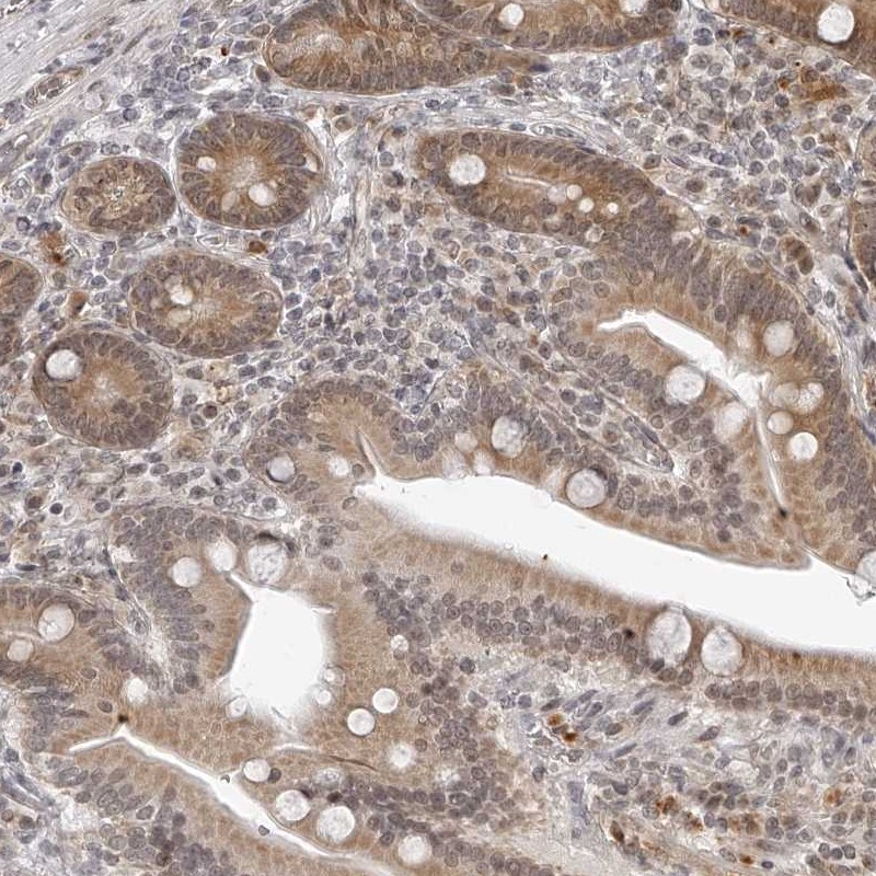 Atlas Antibodies Anti-ODF2L Antibody