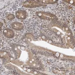 Atlas Antibodies Anti-ODF2L Antibody